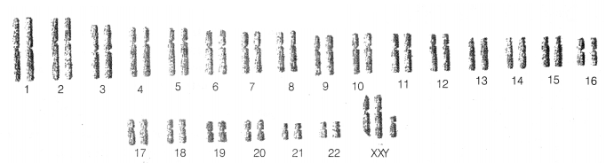 CBSE Sample Papers for Class 12 Biology Set 12 with Solutions 11