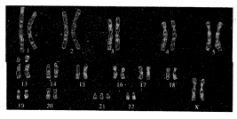 CBSE Sample Papers for Class 12 Biology Set 9 with Solutions 10